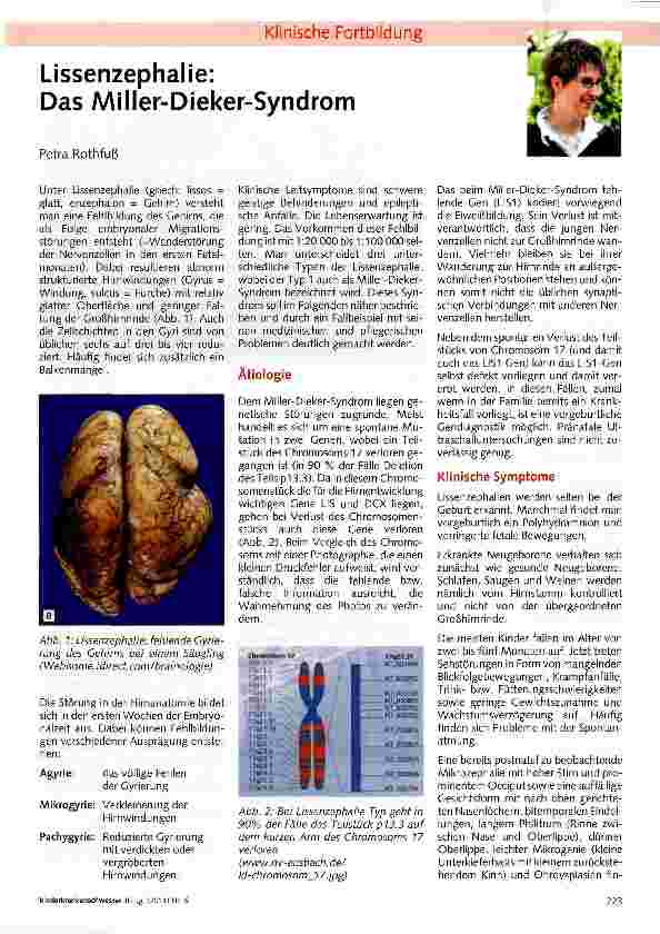 Vorschauseite 1: Lissenzephalie: Das Miller-Dieker-Syndrom