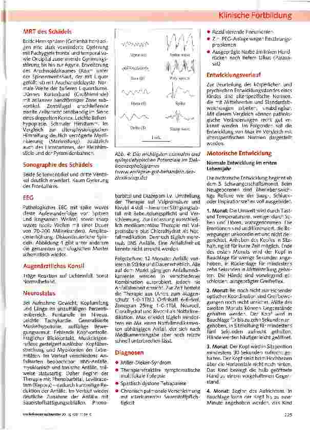 Vorschauseite 3: Lissenzephalie: Das Miller-Dieker-Syndrom