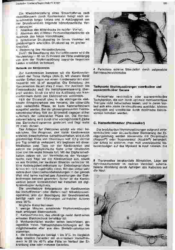 Vorschauseite 4: Elektrotherapie des Herzens