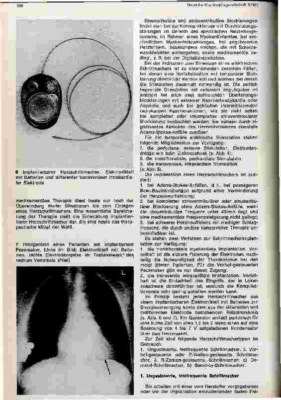 Vorschauseite 5: Elektrotherapie des Herzens