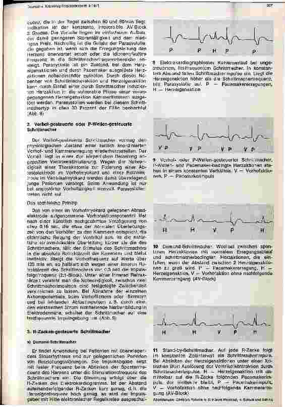 Vorschauseite 6: Elektrotherapie des Herzens