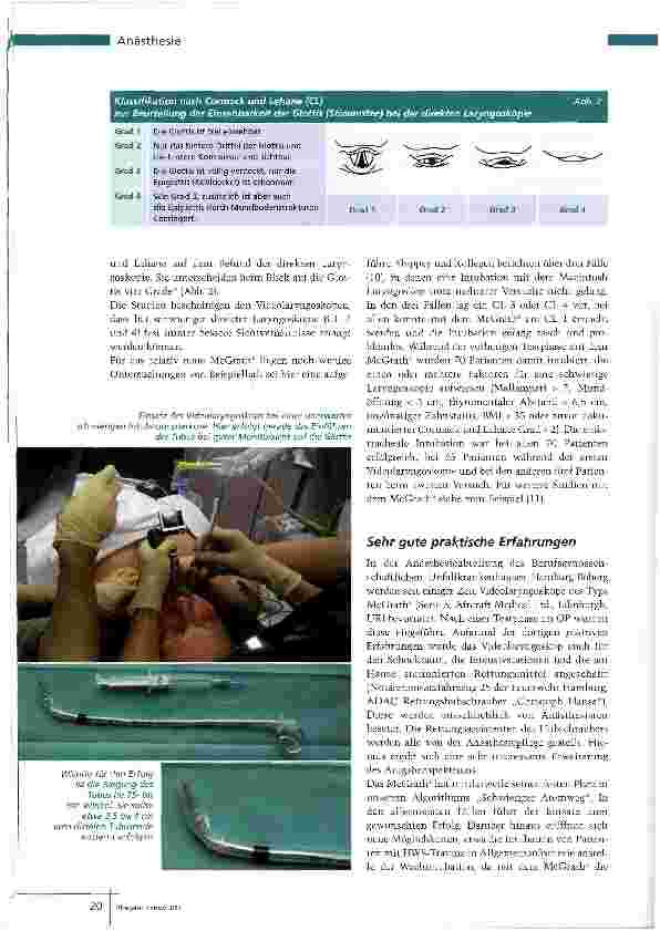 Vorschauseite 3: Intubation mittels Video