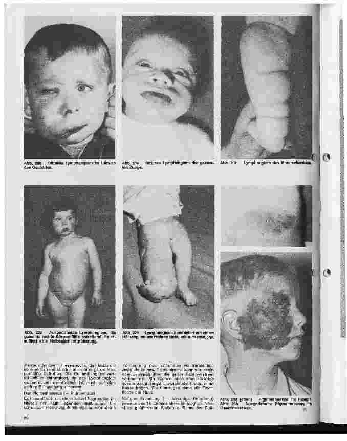 Vorschauseite 3: Kinderchirurgie 3. Folge: Allgemeine kinderchirurgischen Begriffe und Krankheiten