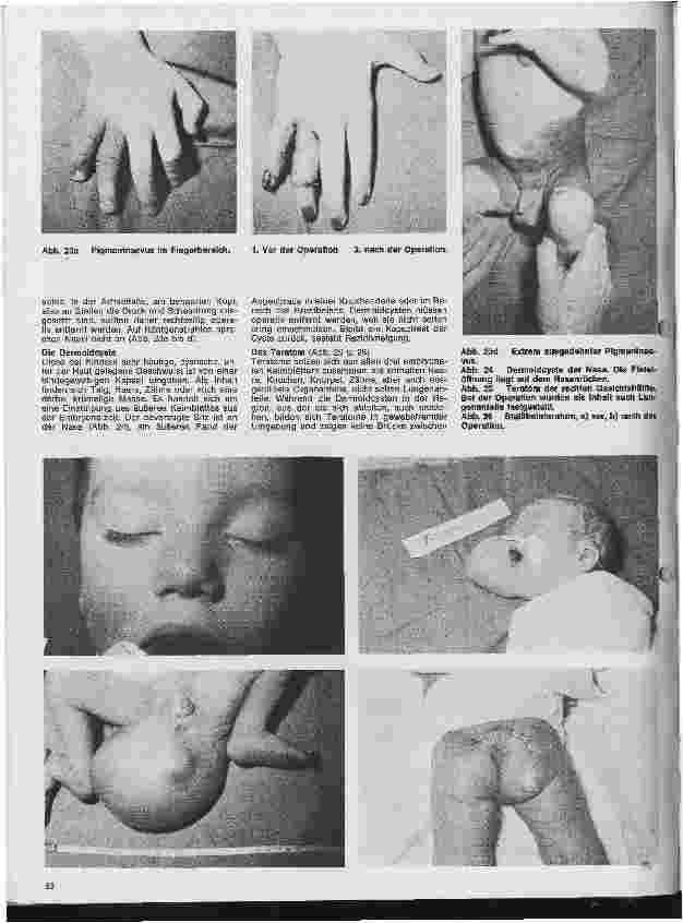 Vorschauseite 4: Kinderchirurgie 3. Folge: Allgemeine kinderchirurgischen Begriffe und Krankheiten