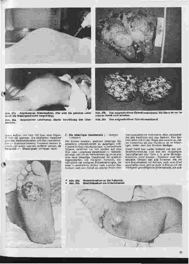 Vorschauseite 5: Kinderchirurgie 3. Folge: Allgemeine kinderchirurgischen Begriffe und Krankheiten