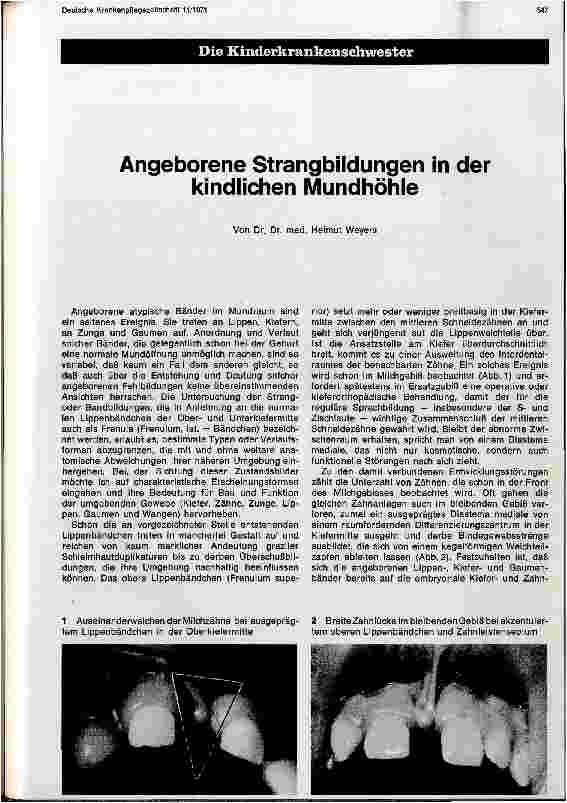 Vorschauseite 1: Angeborene Strangbildungen in der kindlichen Mundhöhle