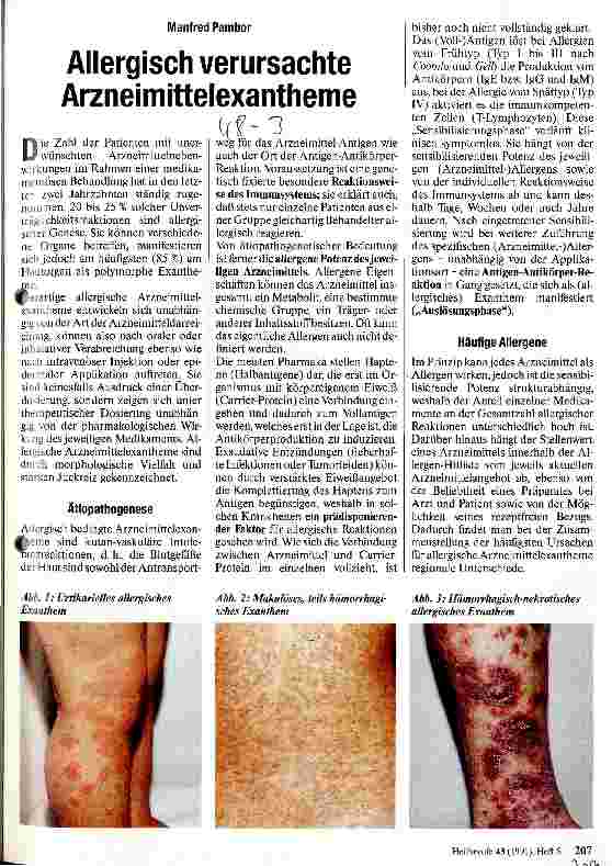 Vorschauseite 1: Allergisch verursachte Arzneimittelexantheme