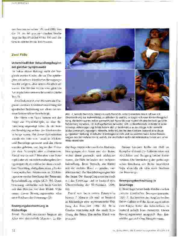 Vorschauseite 3: Physiotherapie bei neurologisch bedingten Bewegungsstörungen im Kindesalter