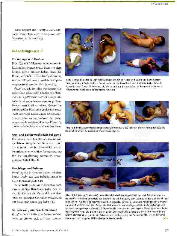 Vorschauseite 4: Physiotherapie bei neurologisch bedingten Bewegungsstörungen im Kindesalter