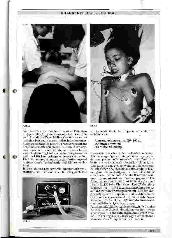 Vorschauseite 2: Pflegerisch therapeutische Maßnahmen bei der Beatmung hoch querschnittsgelähmter Kinder
