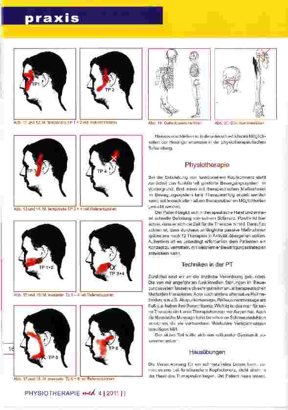 Vorschauseite 5: Funktioneller Kopfschmerz Therapeutische Möglichkeiten zur Schmerzreduktion und Schmerzbeseitigung