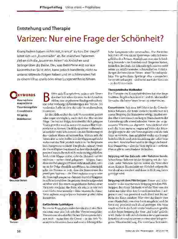 Vorschauseite 1: Varizen: Nur eine Frage der Schönheit?