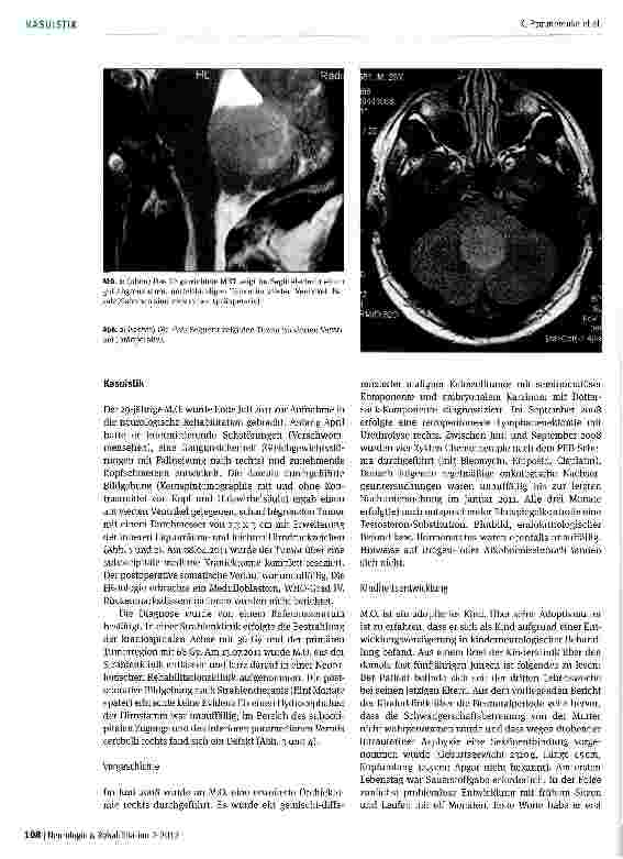 Vorschauseite 3: Ein Fall von retrograder Amnesie nach Resektion eines Medulloblastoms -psychogen, organisch, funktioneil?