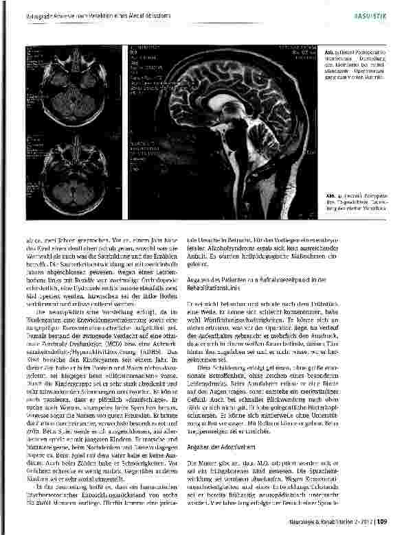 Vorschauseite 4: Ein Fall von retrograder Amnesie nach Resektion eines Medulloblastoms -psychogen, organisch, funktioneil?