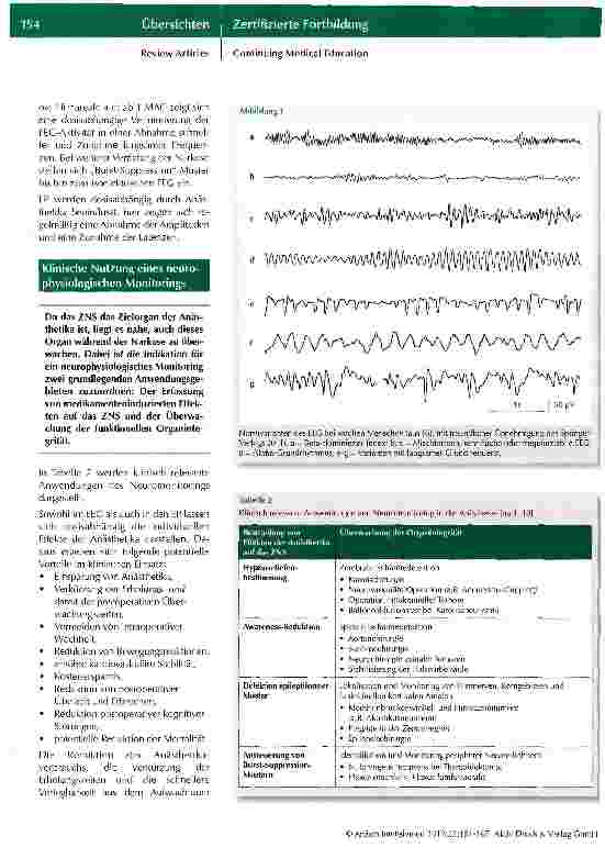 Vorschauseite 4: Neuromonitoring in der Anästhesiologie
