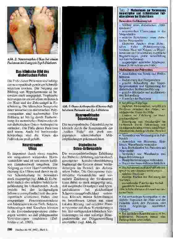 Vorschauseite 3: Klinische Krankheitsbilder des diabetischen Fußes und ihre Behandlung