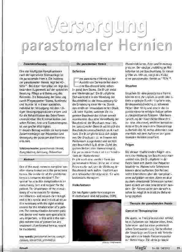 Vorschauseite 1: Versorgung parastomaler Hernien
