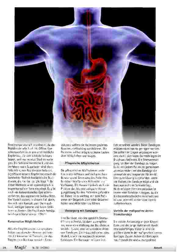 Vorschauseite 2: Versorgung parastomaler Hernien