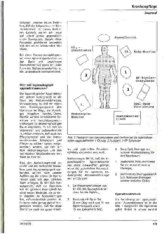 Vorschauseite 2: Die laparoskopische Appendektomie