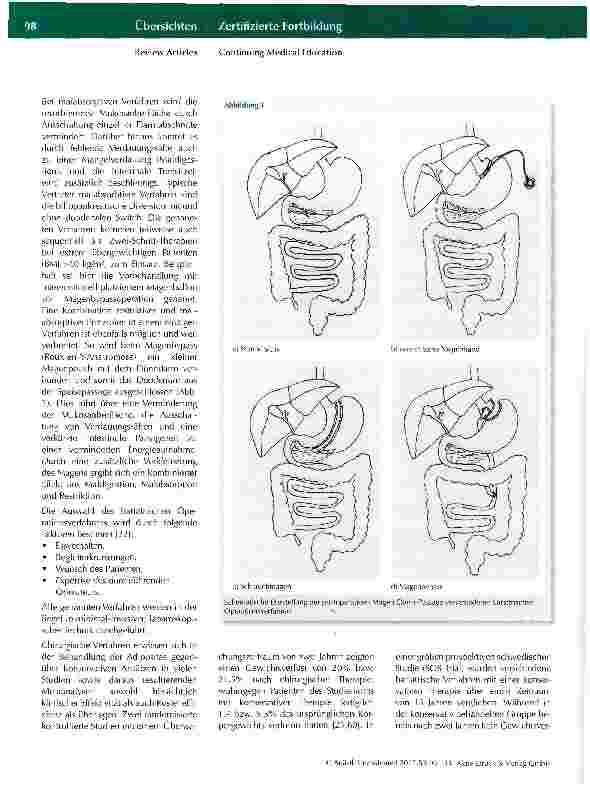 Vorschauseite 3: Die anästhesiologische Versorgung bei bariatrischen Eingriffen