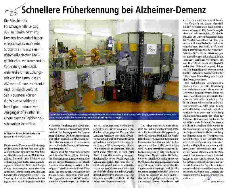 Vorschauseite 1: Schnellere Früherkennung bei Alzheimer-Demenz