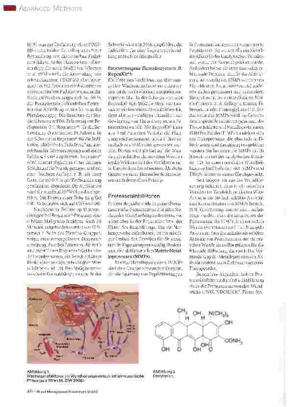 Vorschauseite 2: „Advanced Methods in der Wundbehandlung