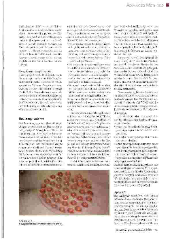 Vorschauseite 5: „Advanced Methods in der Wundbehandlung