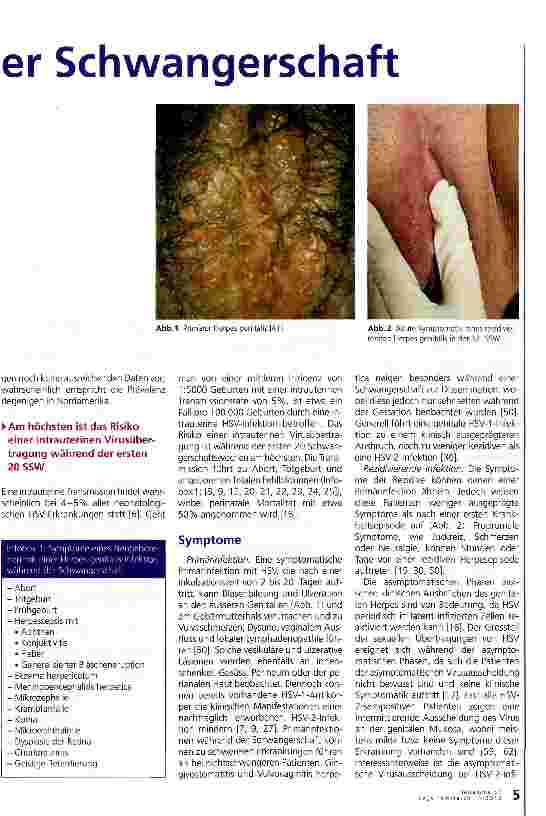 Vorschauseite 2: Herpes genitalis in der Schwangerschaft