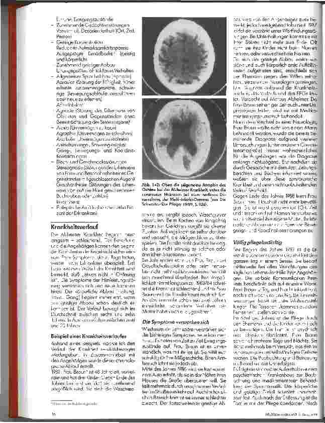 Vorschauseite 2: Die Alzheimer Krankheit