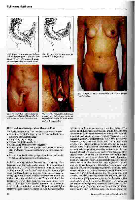Vorschauseite 4: Transsexualität