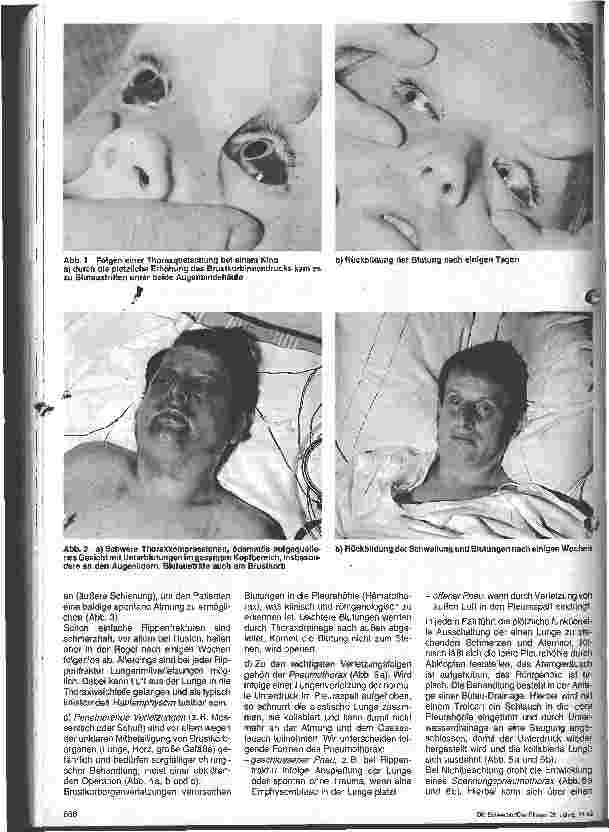 Vorschauseite 2: Chirurgische Krankenpflege - 6. Folge Thorax