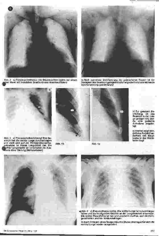 Vorschauseite 3: Chirurgische Krankenpflege - 6. Folge Thorax