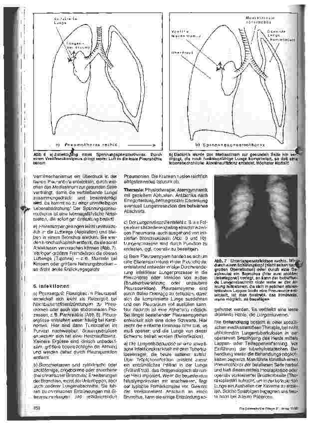 Vorschauseite 4: Chirurgische Krankenpflege - 6. Folge Thorax