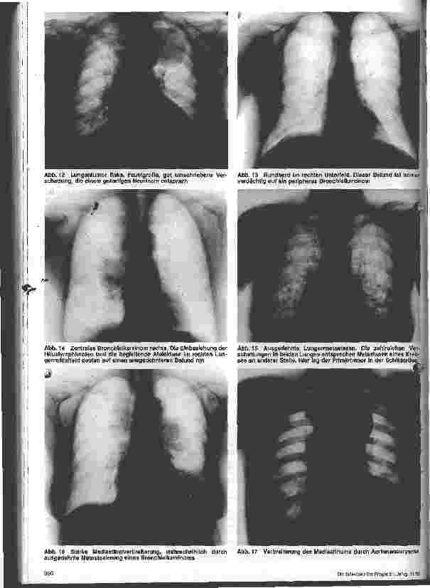 Vorschauseite 6: Chirurgische Krankenpflege - 6. Folge Thorax