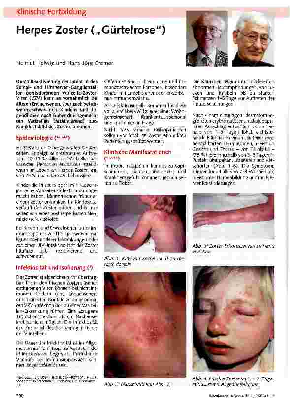 Vorschauseite 1: Herpes Zoster („Gürtelrose)
