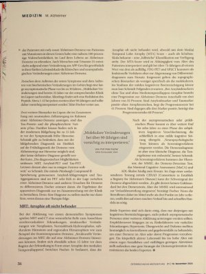 Vorschauseite 3: Depression maskiert Demenz