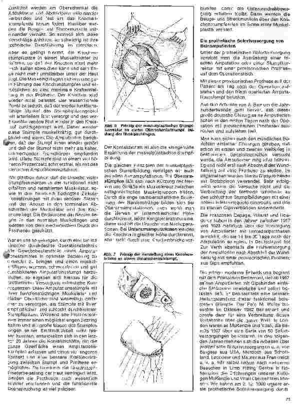 Vorschauseite 4: Moderne Entwicklung in der Orthopädie 3. Folge: