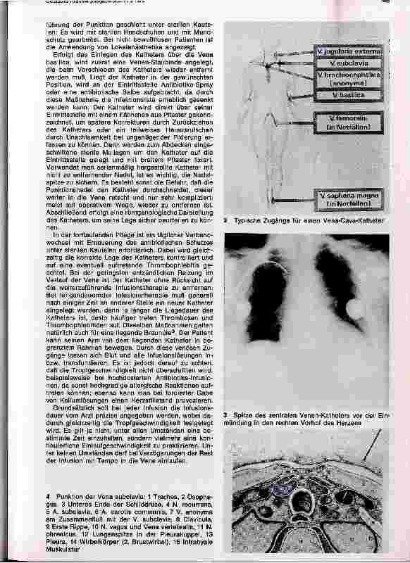 Vorschauseite 2: Praktische Druchführung von Infusionen und Bluttransfusionen