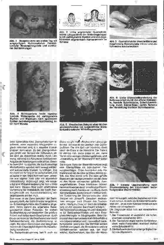 Vorschauseite 2: Die kinderchirurgische Versorgung bei Spina bifida und Hydrocephalus internus