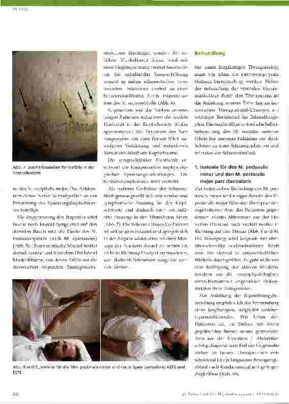 Vorschauseite 3: Zur Anatomie und Therapie des Spannungskopfschmerzes