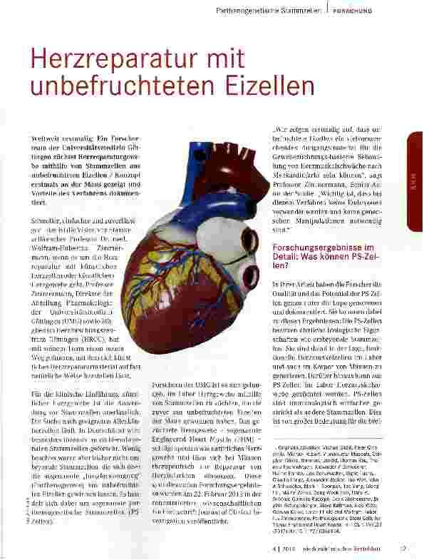 Vorschauseite 1: Herzreparatur mit unbefruchteten Eizellen
