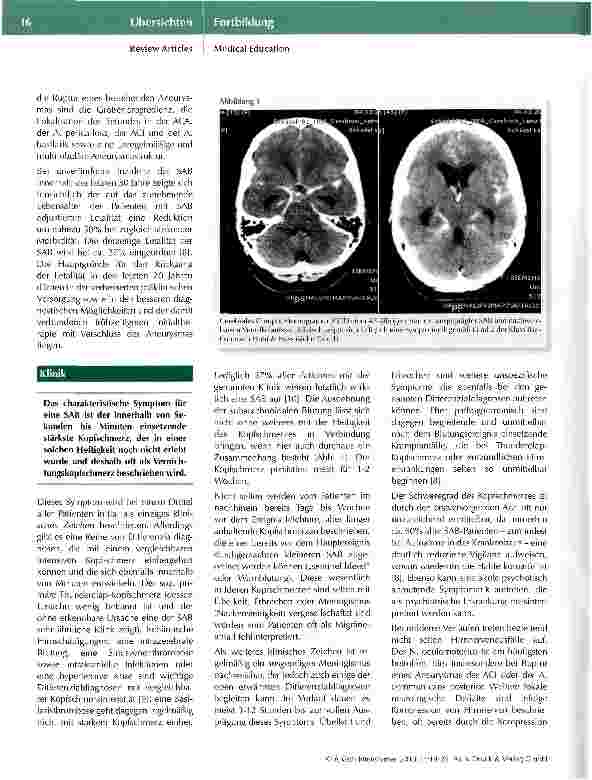 Vorschauseite 3: Diagnose und Therapie der atraumatischen Subarachnoidalblutung