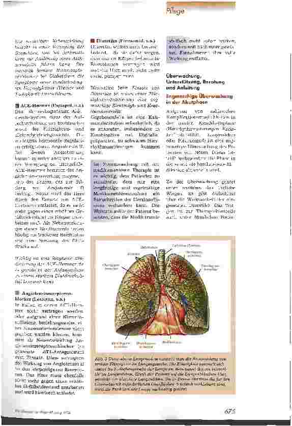 Vorschauseite 4: Pflege bei Herzinsuffizienz