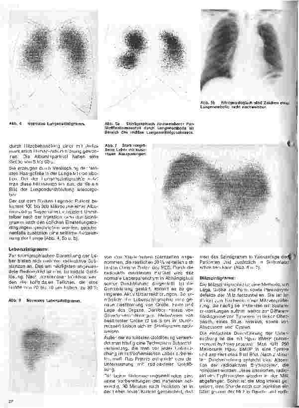 Vorschauseite 5: Radiologie 11.Folge: Diagnostische Methoden der Nuklearmedizin