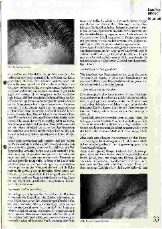Vorschauseite 3: Die Schuppenflechte (Psoriasis vulgaris)