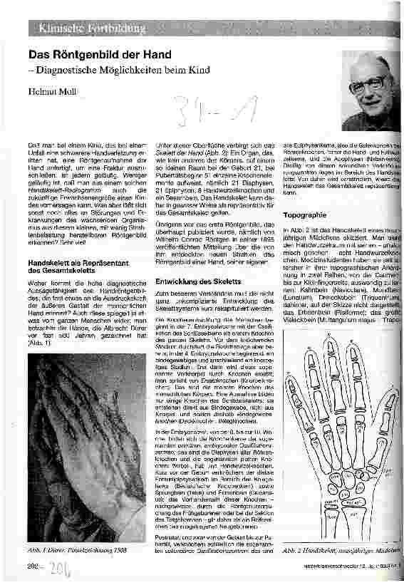 Vorschauseite 1: Das Röntgenbild der Hand Diagnostische Möglichkeiten beim Kind