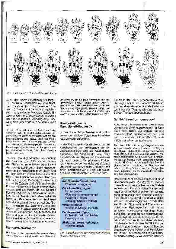 Vorschauseite 2: Das Röntgenbild der Hand Diagnostische Möglichkeiten beim Kind