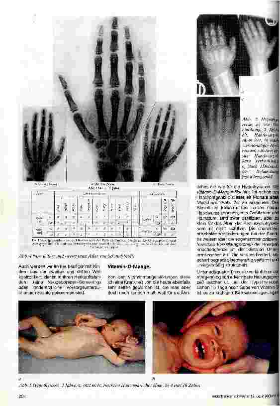 Vorschauseite 3: Das Röntgenbild der Hand Diagnostische Möglichkeiten beim Kind