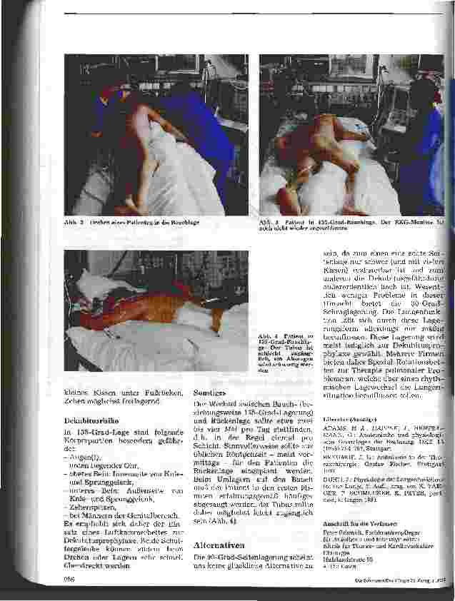 Vorschauseite 4: Beatmung in Bauchlage Durchführung, Indikation, Auswirkung