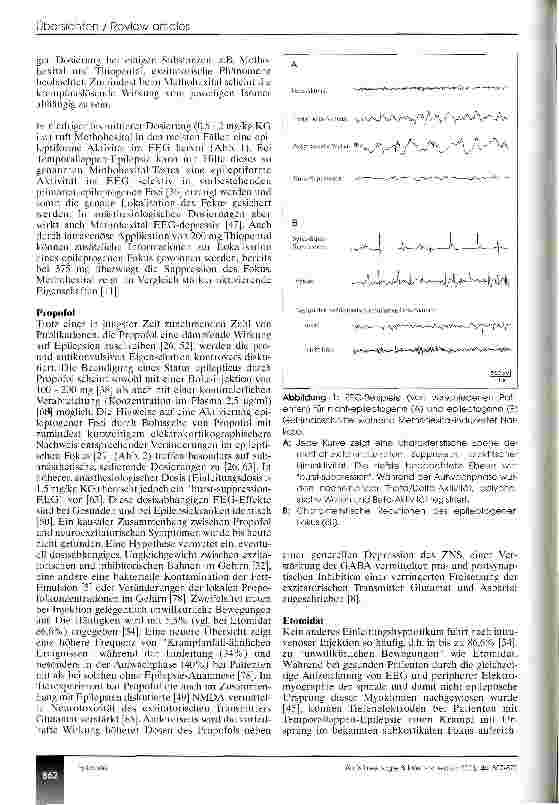 Vorschauseite 6: Anästhesie und Epilepsie - eine Übersicht (CME 12/03)